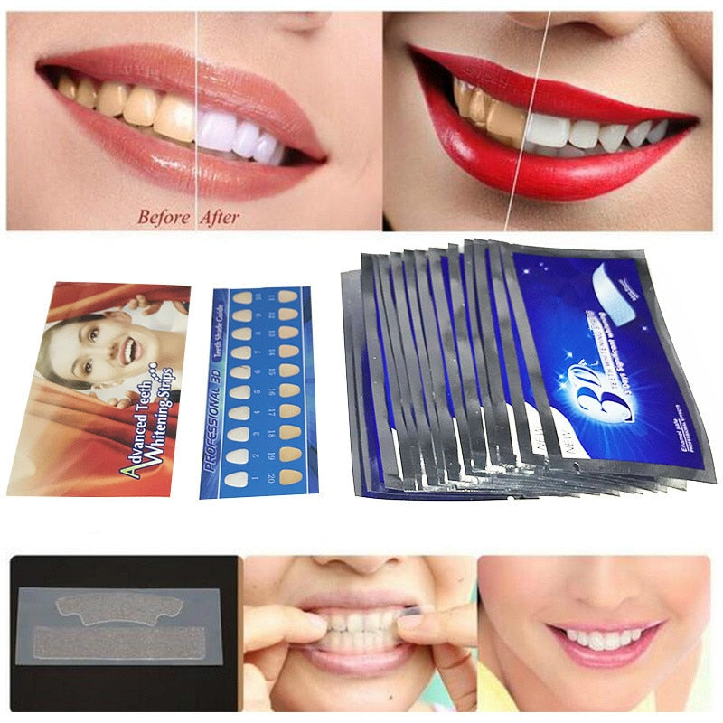 Heonyirry Teeth Whitening Gel Strips - 14 Pairs 