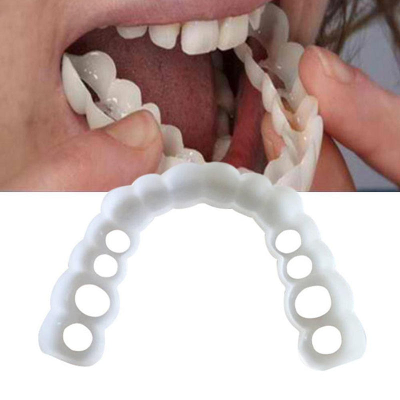 Removable Dental Veneers - Snap On Smile 