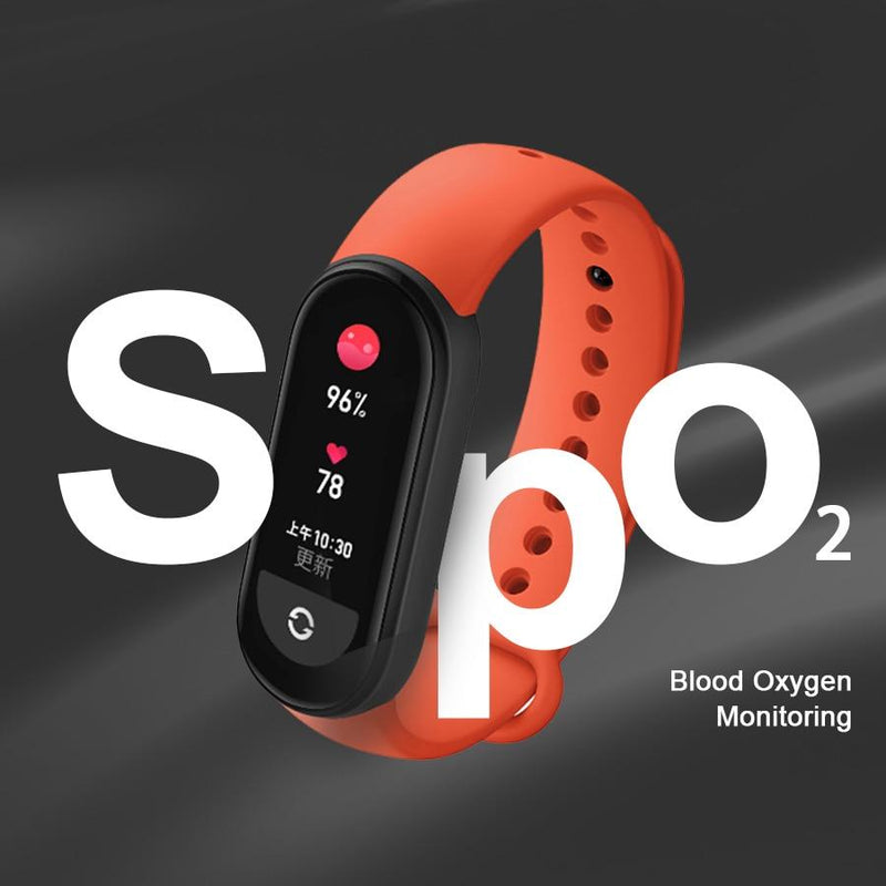 Reloj inteligente Xiaomi Mi Band 6 NFC 