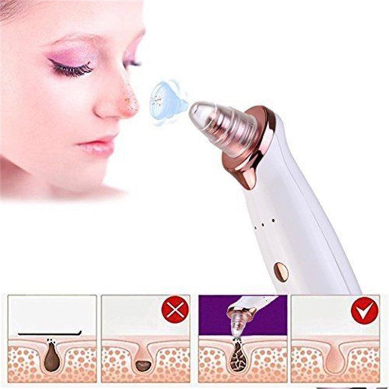 Vacuum Blackhead Remover - Suction Extraction